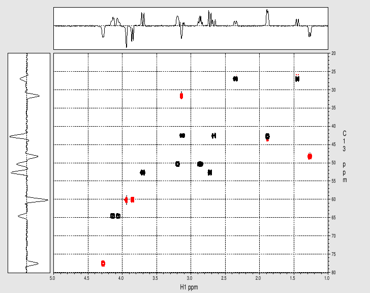 1H-13C HSQC expansion